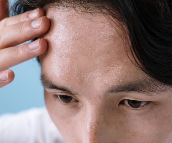 Ces coups de fatigue qui vous collent à la peau (et ce qu’on n’ose pas demander)
